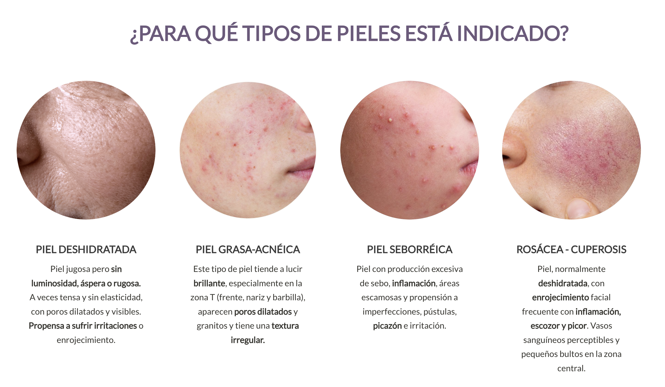 serum-az-dehesia-tipo-piel.png